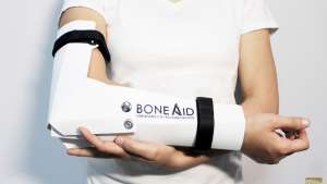 BoneAid is a multi-purpose bone rehabilitation board created for disaster relief emergencies.